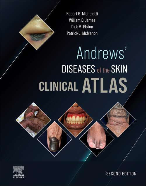 Book cover of Andrews' Diseases of the Skin Clinical Atlas,E-Book: Andrews' Diseases of the Skin Clinical Atlas,E-Book (2)