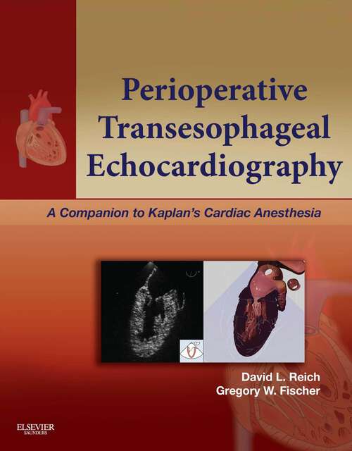 Book cover of Perioperative Transesophageal Echocardiography E-Book: A Companion to Kaplan's Cardiac Anesthesia (Expert Consult: Online)