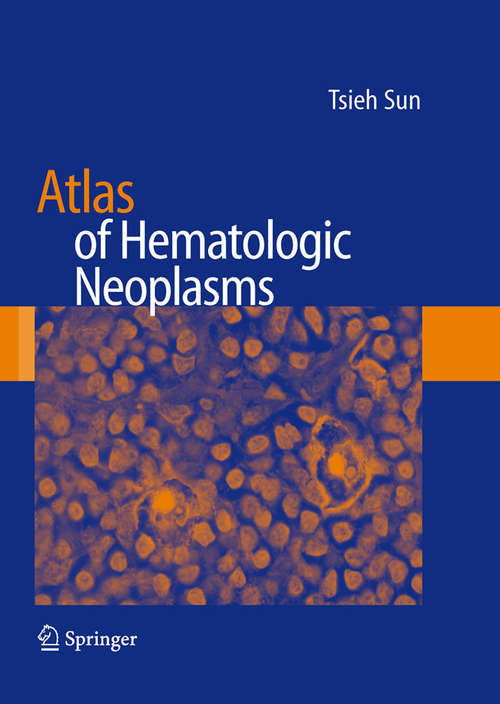 Book cover of Atlas of Hematologic Neoplasms (2009)