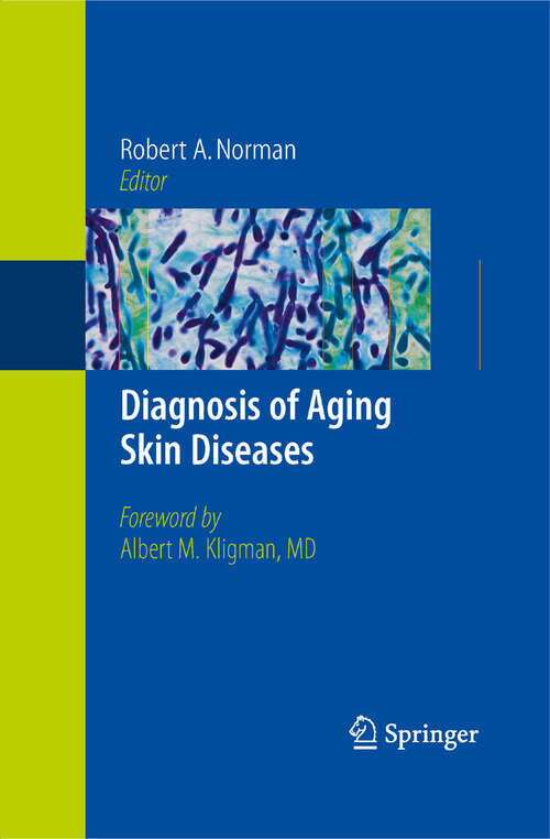 Book cover of Diagnosis of Aging Skin Diseases (2008)