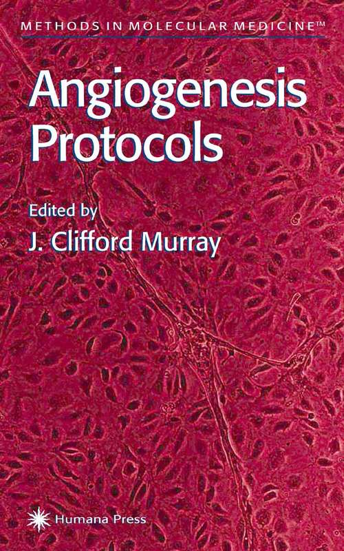 Book cover of Angiogenesis Protocols (2001) (Methods in Molecular Medicine #46)