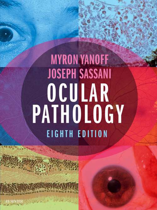 Book cover of Ocular Pathology: A Text And Atlas (8)