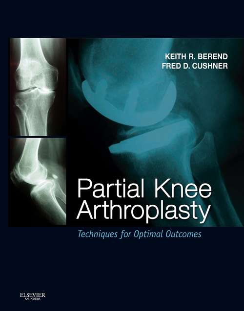 Book cover of Partial Knee Arthroplasty E-Book: Techniques and Optimal Outcomes - Expert Consult