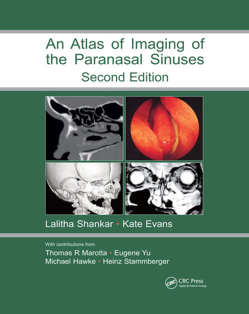 Book cover of Atlas of Imaging of the Paranasal Sinuses, Second Edition (2)