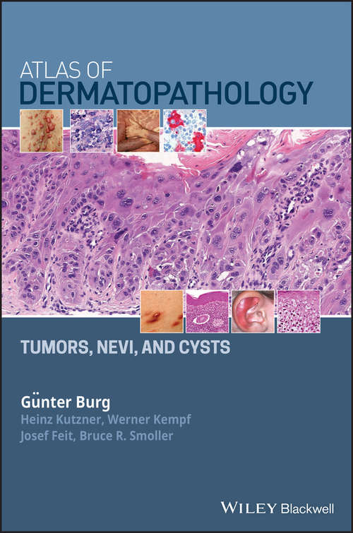 Book cover of Atlas of Dermatopathology: Tumors, Nevi, and Cysts
