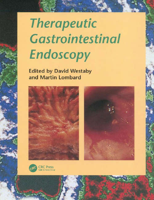Book cover of Therapeutic Gastrointestinal Endoscopy
