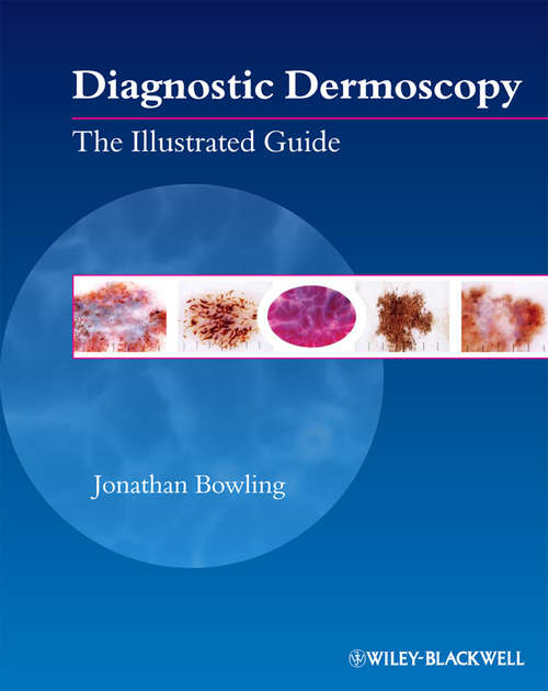 Book cover of Diagnostic Dermoscopy: The Illustrated Guide