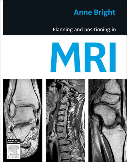 Book cover of Planning and Positioning in MRI - E-Book