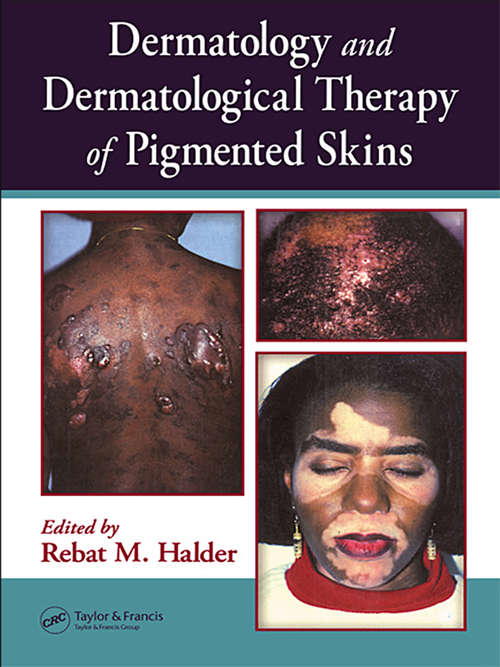 Book cover of Dermatology and Dermatological Therapy of Pigmented Skins