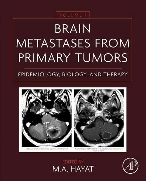 Book cover of Brain Metastases from Primary Tumors Volume 1: Epidemiology, Biology, and Therapy