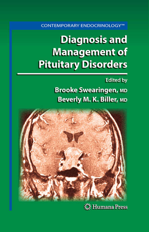 Book cover of Diagnosis and Management of Pituitary Disorders (2008) (Contemporary Endocrinology)