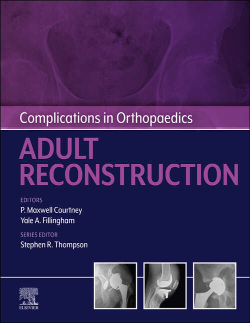 Book cover of Complications in Orthopaedics: Adult Reconstruction - E-Book