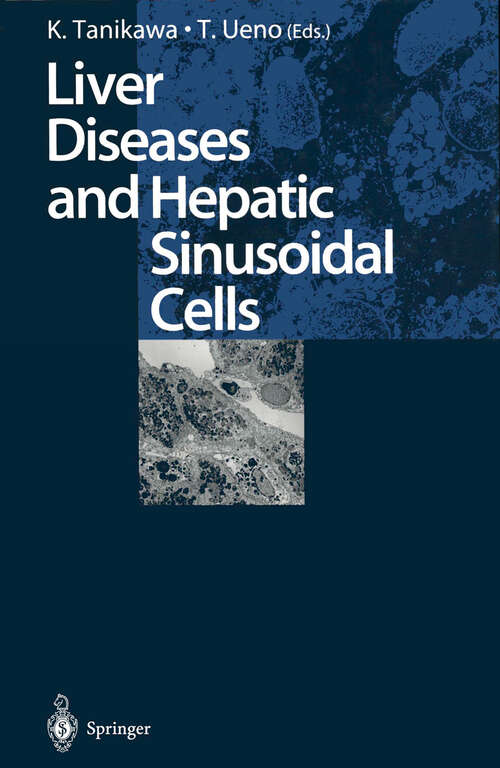 Book cover of Liver Diseases and Hepatic Sinusoidal Cells (1999)