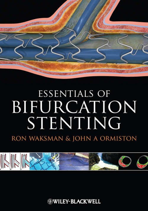 Book cover of Bifurcation Stenting