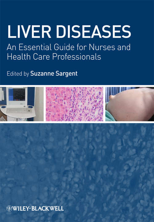 Book cover of Liver Diseases: An Essential Guide for Nurses and Health Care Professionals