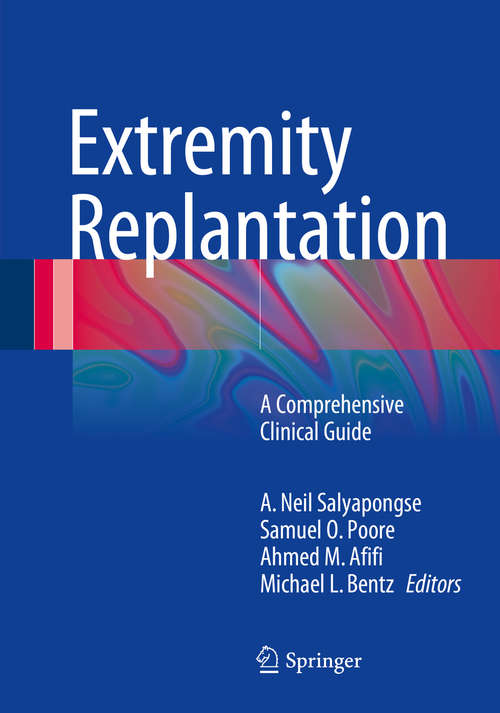 Book cover of Extremity Replantation: A Comprehensive Clinical Guide (2015)