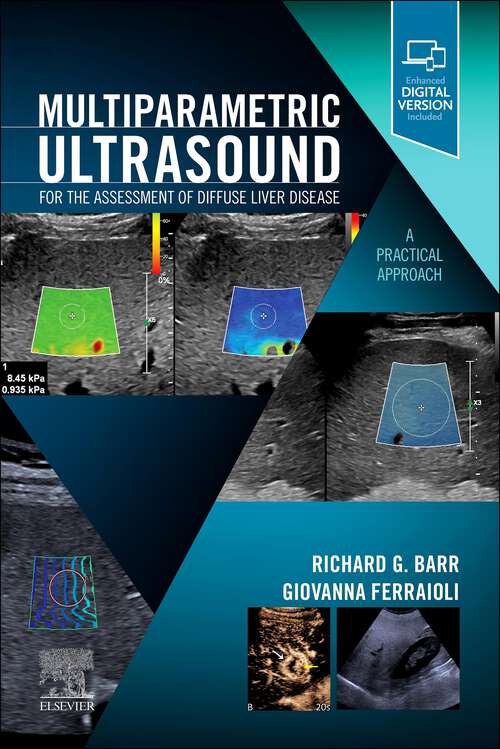 Book cover of Multiparametric Ultrasound for the Assessment of Diffuse Liver Disease - E-Book: A Practical Approach