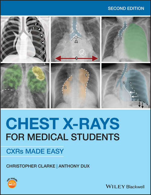 Book cover of Chest X-Rays for Medical Students (2)