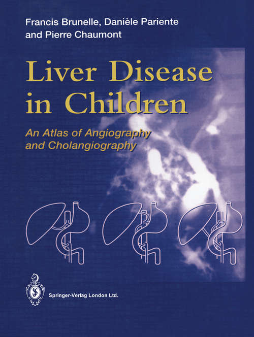 Book cover of Liver Disease in Children: An Atlas of Angiography and Cholangiography (1994)