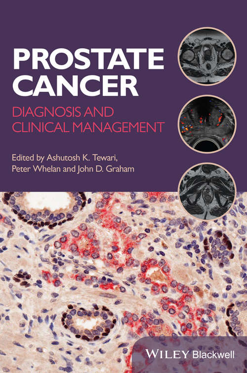 Book cover of Prostate Cancer: Diagnosis and Clinical Management
