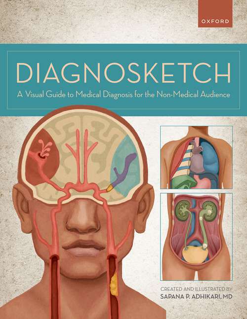 Book cover of Diagnosketch: A Visual Guide to Medical Diagnosis for the Non-Medical Audience