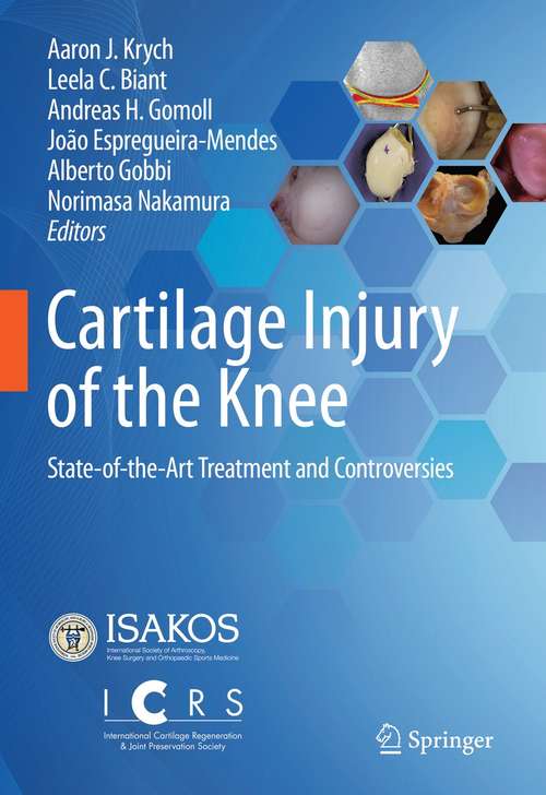 Book cover of Cartilage Injury of the Knee: State-of-the-Art Treatment and Controversies (1st ed. 2021)