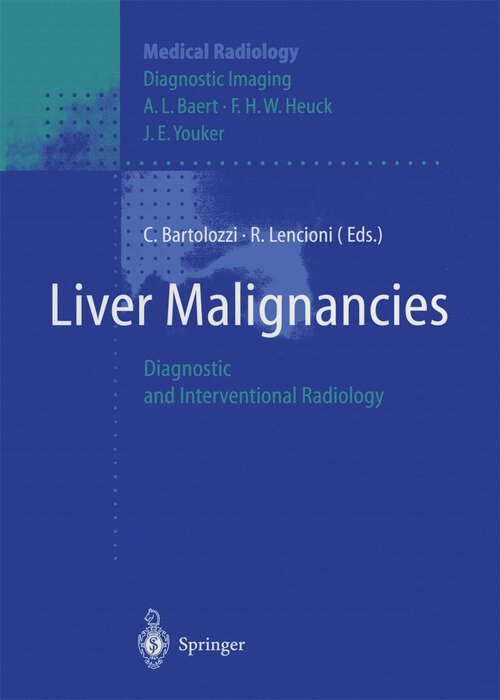 Book cover of Liver Malignancies: Diagnostic and Interventional Radiology (1999) (Medical Radiology)