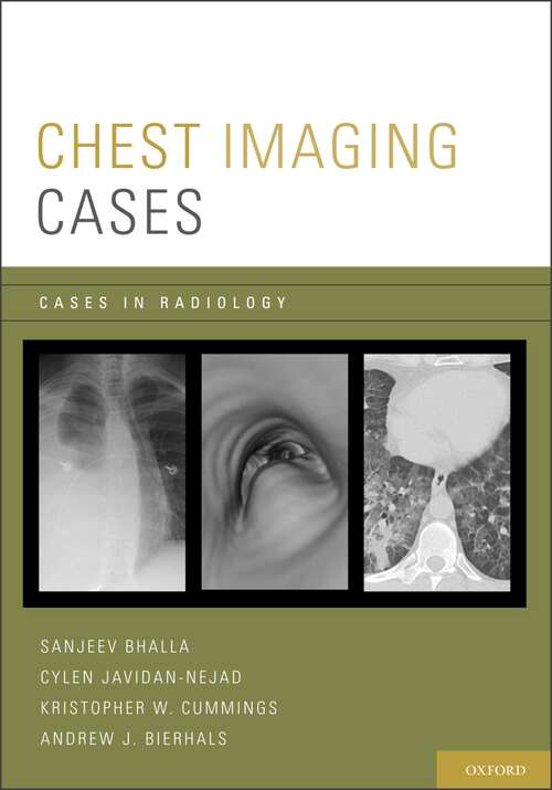 Book cover of Chest Imaging Cases (Cases in Radiology)