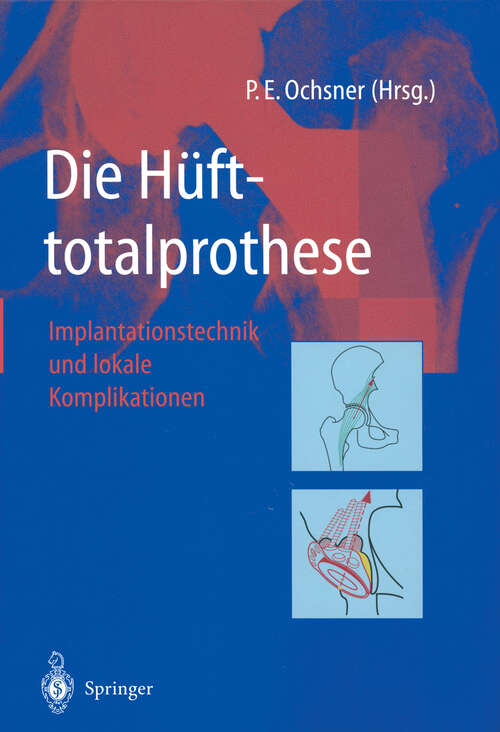 Book cover of Die Hüfttotalprothese: Implantationstechnik und lokale Komplikationen (2003)