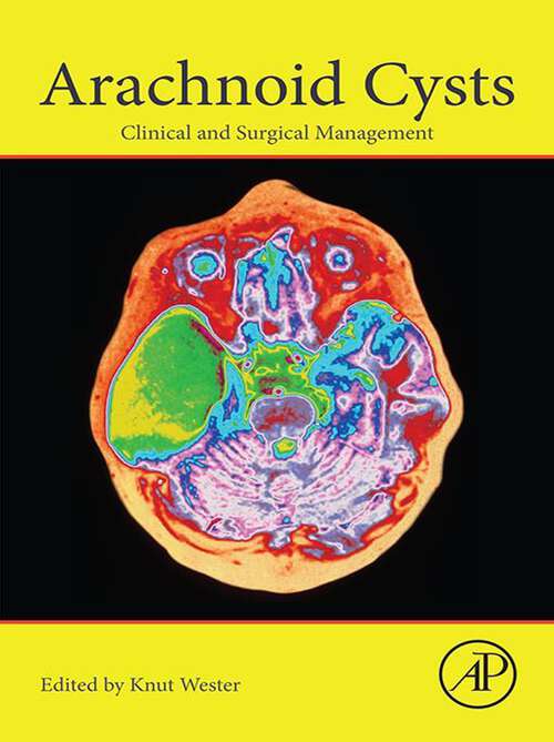 Book cover of Arachnoid Cysts: Clinical and Surgical Management