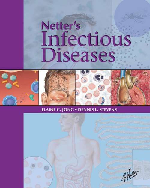 Book cover of Netter's Infectious Diseases E-Book: Netter's Infectious Diseases E-Book