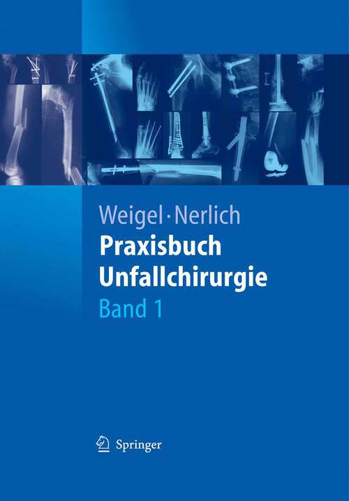 Book cover of Praxisbuch Unfallchirurgie (2005)