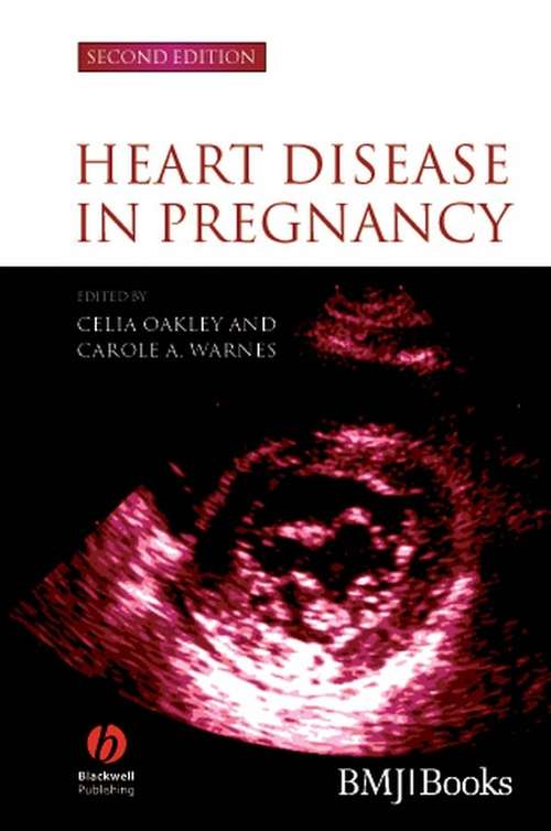 Book cover of Heart Disease in Pregnancy (2)