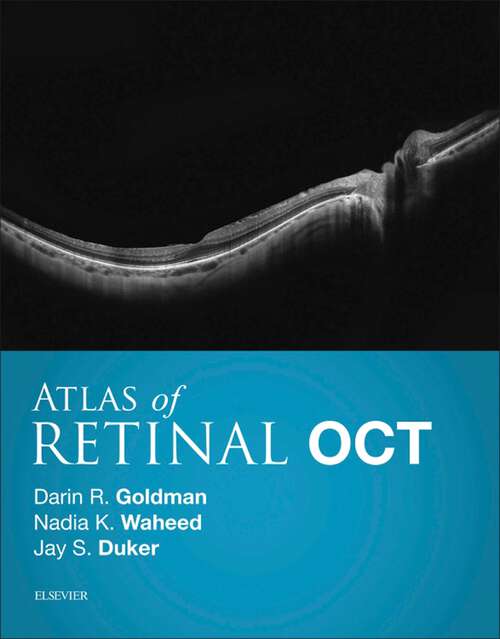 Book cover of Atlas of Retinal OCT E-Book: Optical Coherence Tomography