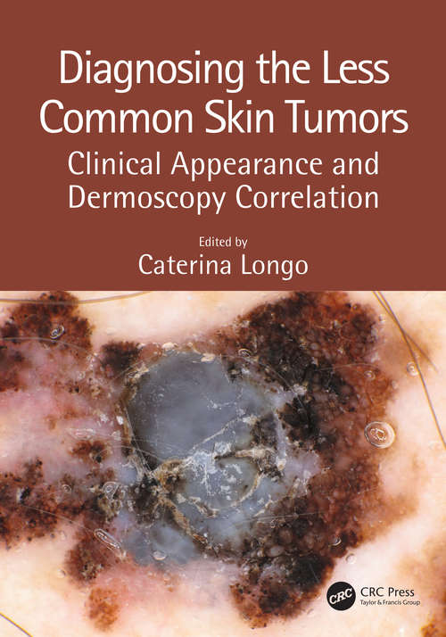 Book cover of Diagnosing the Less Common Skin Tumors: Clinical Appearance and Dermoscopy Correlation