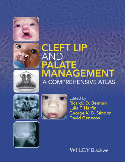 Book cover of Cleft Lip and Palate Management: A Comprehensive Atlas