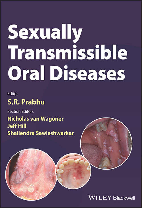 Book cover of Sexually Transmissible Oral Diseases