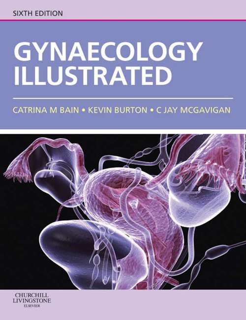 Book cover of Gynaecology Illustrated E-Book: Gynaecology Illustrated E-Book (6)