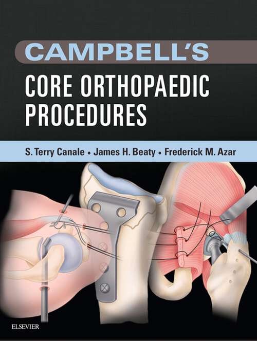 Book cover of Campbell's Core Orthopaedic Procedures E-Book