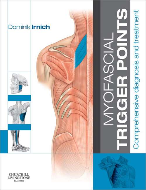 Book cover of Myofascial Trigger Points: Comprehensive diagnosis and treatment