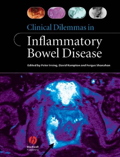 Book cover of Clinical Dilemmas in Inflammatory Bowel Disease