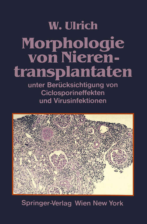 Book cover of Morphologie von Nierentransplantaten: unter Berücksichtigung von Ciclosporineffekten und Virusinfektionen (1987)