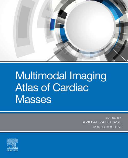 Book cover of Multimodal Imaging Atlas of Cardiac Masses - E-Book