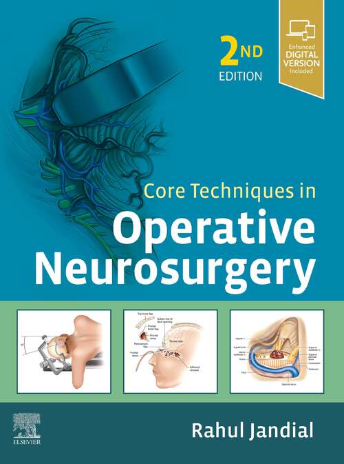 Book cover of Core Techniques in Operative Neurosurgery E-Book: Expert Consult - Online (2)