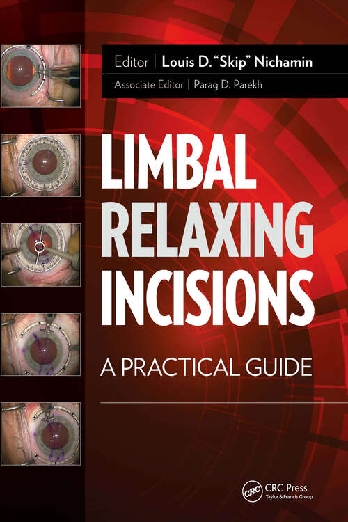Book cover of Limbal Relaxing Incisions: A Practical Guide