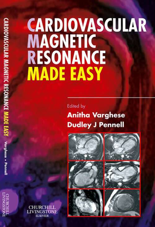 Book cover of Cardiovascular Magnetic Resonance Made Easy (Made Easy)