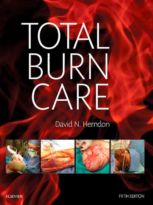 Book cover of Total Burn Care E-Book: Expert Consult - Online (5)