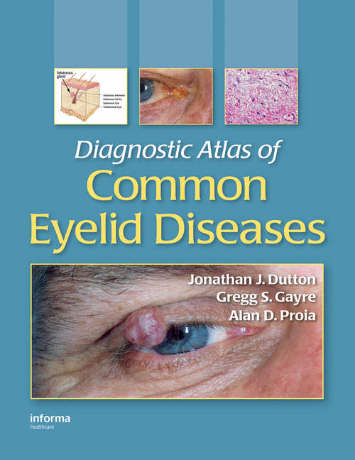 Book cover of Diagnostic Atlas of Common Eyelid Diseases