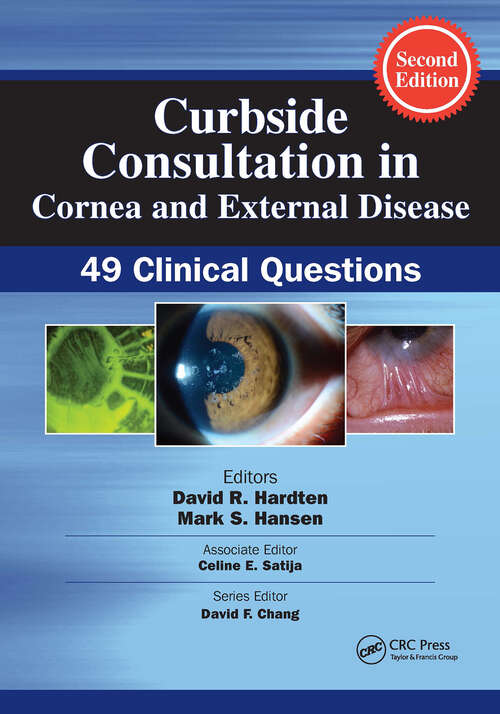 Book cover of Curbside Consultation in Cornea and External Disease: 49 Clinical Questions (Curbside Consultation in Ophthalmology)