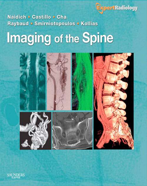 Book cover of Imaging of the Spine E-Book: Expert Radiology Series (Expert Radiology)